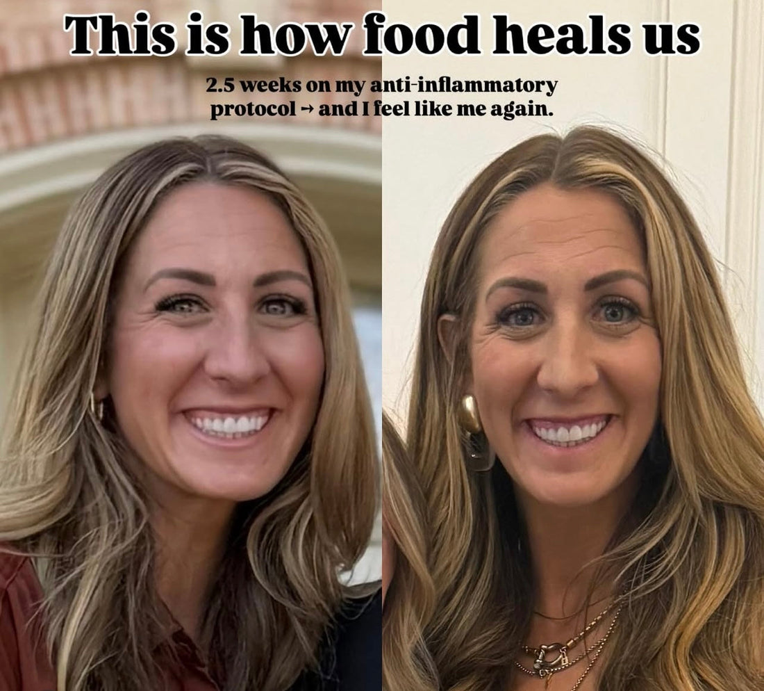 2.5 Weeks into my Anti-Inflammatory Protocol
