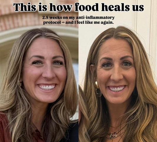 2.5 Weeks into my Anti-Inflammatory Protocol